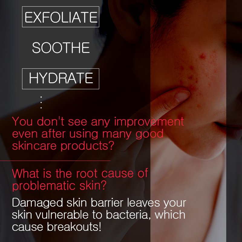 BOM AC Red Free Cleansing Foam - Image 4